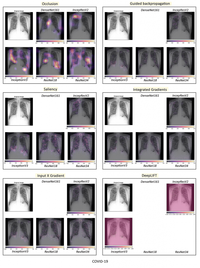 COVID-19 Future Forecasting Using Supervised Machine Learning Models