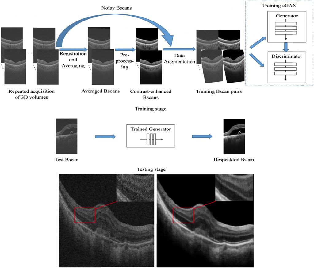 Two-Stage Convolutional Neural Network(CNN) for Medical Noise Removal via Image Decomposition