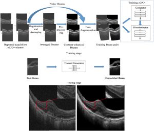 Two-Stage Convolutional Neural Network(CNN) for Medical Noise Removal via Image Decomposition