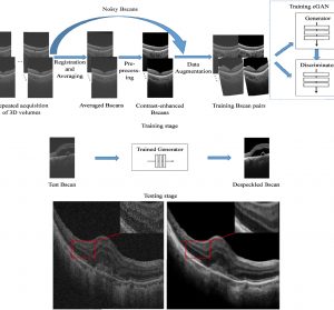 Two-Stage Convolutional Neural Network(CNN) for Medical Noise Removal via Image Decomposition