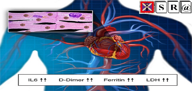 respiratory syndrome coronavirus