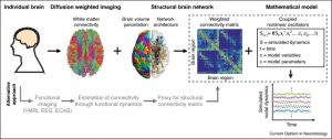 EEG signal cleaning for drowsiness detection
