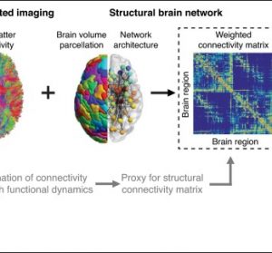 EEG signal cleaning for drowsiness detection