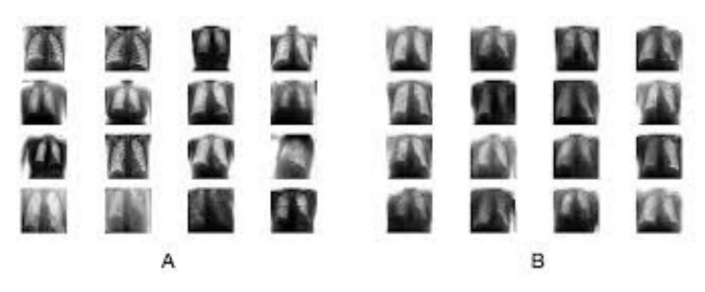 CovidGAN: Data Augmentation Using Auxiliary Classifier GAN for Improved Covid-19 Detection