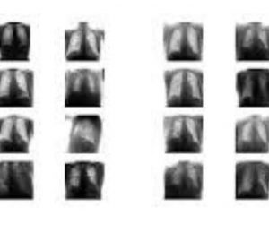 CovidGAN: Data Augmentation Using Auxiliary Classifier GAN for Improved Covid-19 Detection