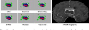 High-Resolution Encoder–Decoder Networks for Low-Contrast Medical Image Segmentation