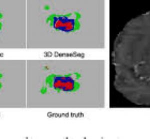 High-Resolution Encoder–Decoder Networks for Low-Contrast Medical Image Segmentation