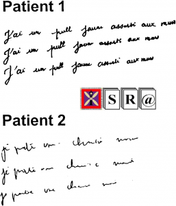 Understanding Cohesion in Writings and Speech ofSchizophrenia Patients
