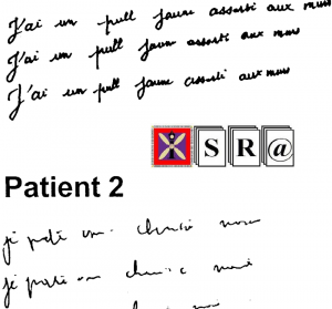 Understanding Cohesion in Writings and Speech ofSchizophrenia Patients